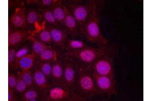 Immunofluorescence staining of methanol-fixed MCF cells using Progesterone Receptor(Phospho-Ser190) Antibody. (Progesterone Receptor anticorps  (pSer190))