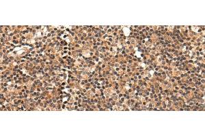 Immunohistochemistry of paraffin-embedded Human tonsil tissue using C16orf45 Polyclonal Antibody at dilution of 1:45(x200) (C16orf45 anticorps)