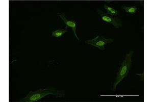 Immunofluorescence of monoclonal antibody to BATF3 on HeLa cell.