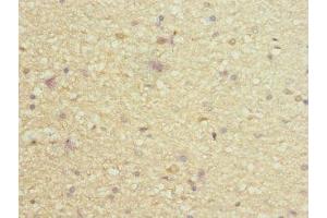 Immunohistochemistry of paraffin-embedded human brain tissue using ABIN7163444 at dilution of 1:100