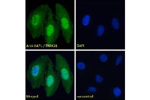 ABIN184913 Immunofluorescence analysis of paraformaldehyde fixed HeLa cells, permeabilized with 0. (KAP1 anticorps  (C-Term))