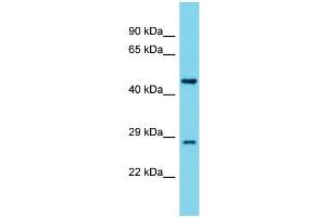 Western Blotting (WB) image for anti-Tyrosyl-tRNA Synthetase 2, Mitochondrial (YARS2) (Middle Region) antibody (ABIN2790889)
