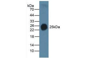 Western blot analysis of Human Serum. (Surfactant Protein C anticorps  (AA 24-197))