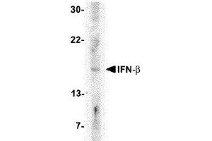 Western Blotting (WB) image for anti-Interferon, beta 1, Fibroblast (IFNB1) (Center) antibody (ABIN2474126) (IFNB1 anticorps  (Center))