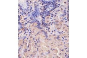 anti-Eukaryotic Translation Initiation Factor 4E Family Member 2 (EIF4E2) antibody