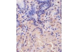 (ABIN650677 and ABIN2838644) staining EIF4E2 in human stomach tissue sections by Immunohistochemistry (IHC-P - paraformaldehyde-fixed, paraffin-embedded sections). (EIF4E2 anticorps)