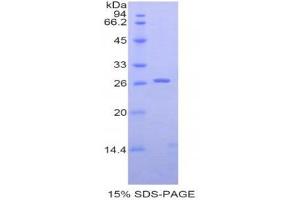 SDS-PAGE (SDS) image for CD22 Molecule (CD22) (AA 28-246) protein (His tag) (ABIN2122084)