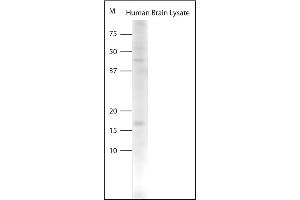 Western blot on human brain lysate using Rabbit antibody to pro BDNF (50-90): . (Pro BDNF anticorps)