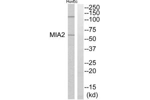 Western blot analysis of extracts from HuvEc cells, using MIA2 antibody. (MIA2 anticorps  (Internal Region))