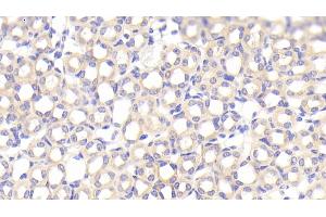 Detection of SFXN1 in Mouse Kidney Tissue using Polyclonal Antibody to Sideroflexin 1 (SFXN1) (SFXN1 anticorps  (AA 2-102))