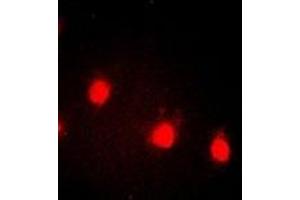 Immunofluorescent analysis of Cyclin E1 (pT77) staining in HEK293T cells.