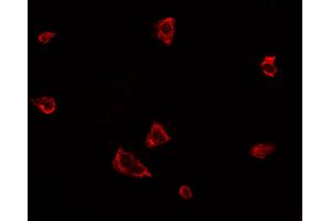 ABIN6277783 staining A549 cells by ICC/IF.