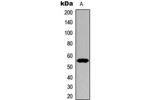 Western blot analysis of Cytochrome P450 21A2 expression in HeLa (A) whole cell lysates. (CYP21A2 anticorps  (Center))