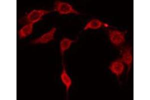 ABIN6267667 staining NIH-3T3 by IF/ICC. (CDC37 anticorps  (pSer13))