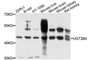 Western blot analysis of extracts of various cells, using UGT2B4 antibody. (UGT2B4 anticorps)