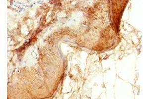 Immunohistochemistry of paraffin-embedded human skin tissue using ABIN7151902 at dilution of 1:100 (EPS15L1 anticorps  (AA 585-864))