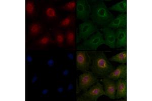 ABIN6263554 and ABIN6277124 staining  cells by IF/ICC. (NDRG1 anticorps  (C-Term))