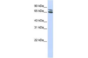WB Suggested Anti-ZBTB48 Antibody Titration: 0. (ZBTB48 anticorps  (Middle Region))