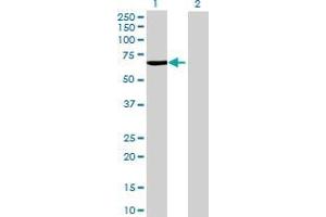 Lane 1: CYP4V2 transfected lysate ( 57.