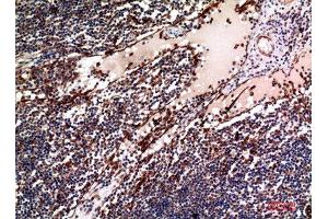 Immunohistochemistry (IHC) analysis of paraffin-embedded Human Lymph, antibody was diluted at 1:100.