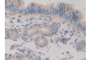 Detection of CHRD in Mouse Uterus Tissue using Polyclonal Antibody to Chordin (CHRD)
