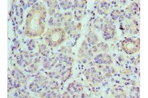Immunohistochemistry of paraffin-embedded human salivary gland tissue using ABIN7175230 at dilution of 1:100