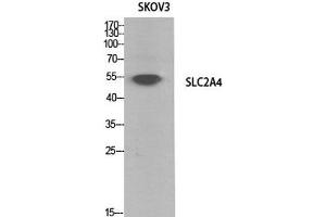 Western Blot analysis of SKOV3 cells using GLUT-4 Polyclonal Antibody at dilution of 1:1000. (GLUT4 anticorps)