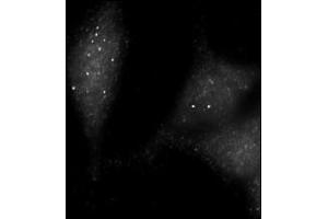 Immunofluorescence staining of Autophagy UVRAG antibody (ABIN388588 and ABIN2849986) on Methanol-fixed HeLa cells.