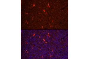 Immunofluorescence analysis of rat spleen cells using RANKL Rabbit pAb (ABIN3016237, ABIN3016238, ABIN3016239 and ABIN6219648) at dilution of 1:100 (40x lens). (RANKL anticorps  (AA 78-317))