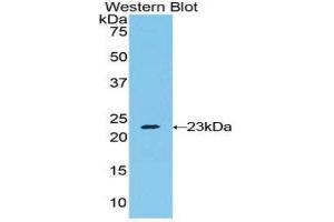 Western Blotting (WB) image for anti-RAD54-Like 2 (RAD54L2) (AA 638-837) antibody (ABIN1860395)