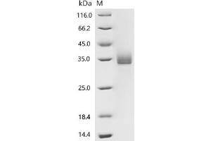 (Tris-Glycine gel) Discontinuous SDS-PAGE (reduced) with 5 % enrichment gel and 15 % separation gel.