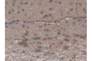 DAB staining on IHC-P; Samples: Rat Brain Tissue (FAS anticorps  (AA 21-170))