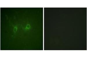 Immunofluorescence analysis of COS7 cells, using RGS16 (Ab-168) Antibody. (RGS16 anticorps  (AA 141-190))