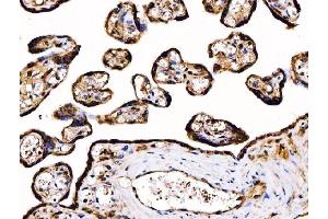 IHC analysis of PDIA6 using anti-PDIA6 antibody (ABIN7600554). (PDIA6 anticorps  (AA 20-440))