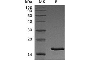 Western Blotting (WB) image for Thymic Stromal Lymphopoietin (TSLP) (Active) protein (His tag) (ABIN7321026)