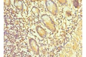 Immunohistochemistry of paraffin-embedded human small intestine tissue using ABIN7164900 at dilution of 1:100 (TAC1 anticorps  (AA 1-129))