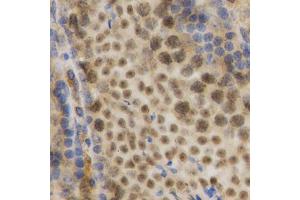 Immunohistochemistry of paraffin-embedded mouse testis using ELAVL1 Antibody.
