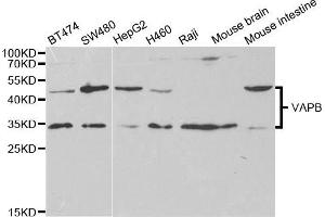 Western blot analysis of extracts of various cell lines, using VAPB antibody (ABIN5973099) at 1/1000 dilution. (VAPB anticorps)