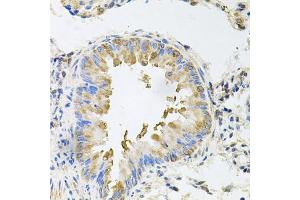 Immunohistochemistry of paraffin-embedded mouse lung using NCR3 antibody (ABIN5974302) at dilution of 1/100 (40x lens).