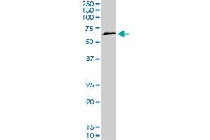 TBX18 monoclonal antibody (M04), clone 3C12.