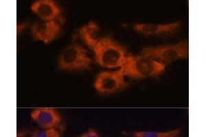 Immunofluorescence analysis of C6 cells using NDRG4 Polyclonal Antibody at dilution of 1:100. (NDRG4 anticorps)