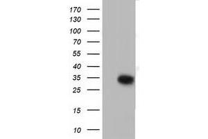 HEK293T cells were transfected with the pCMV6-ENTRY control (Left lane) or pCMV6-ENTRY SULT2A1 (Right lane) cDNA for 48 hrs and lysed.