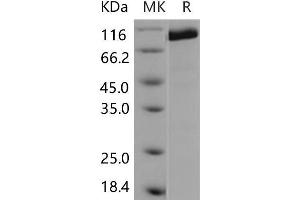 Western Blotting (WB) image for Protein tyrosine Phosphatase, Receptor Type, C (PTPRC) (Active) protein (ABIN7320005) (CD45 Protéine)
