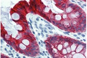 Colon, Human: Formalin-Fixed, Paraffin-Embedded (FFPE) (Cytokeratin 18 anticorps)