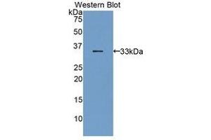Western Blotting (WB) image for anti-Bone Marrow Stromal Cell Antigen 1 (BST1) (AA 28-282) antibody (ABIN1858173)