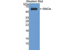 Western blot analysis of the recombinant protein. (CASP14 anticorps  (AA 17-248))
