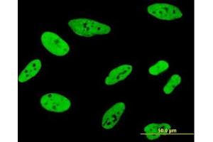 Image no. 5 for anti-Far Upstream Element (FUSE) Binding Protein 1 (FUBP1) (AA 27-137) antibody (ABIN599075) (FUBP1 anticorps  (AA 27-137))