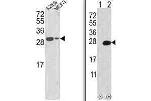 Image no. 1 for anti-Adenine Phosphoribosyltransferase (APRT) (N-Term) antibody (ABIN452753) (APRT anticorps  (N-Term))