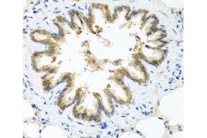 Immunohistochemistry of paraffin-embedded Rat lung using S100A7 Polyclonal Antibody at dilution of 1:100 (40x lens).