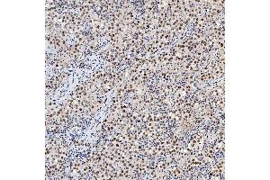 IHC analysis of SNRNP200 using anti-SNRNP200 antibody (ABIN7602032).